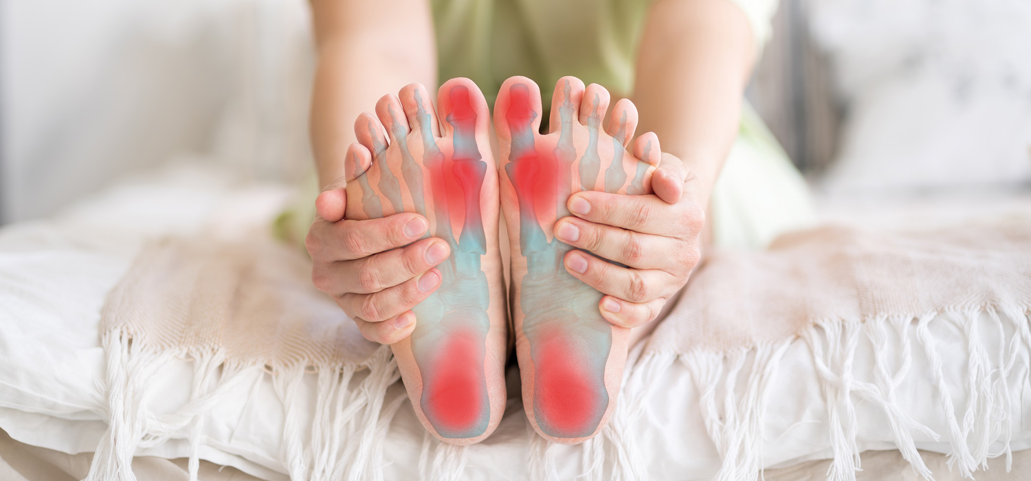 Symbolische Darstellung von gereizten Bereichen am Fuß, die bei Hallux valgus auftreten können.