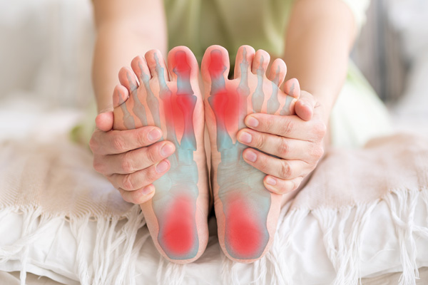 Symbolische Darstellung von gereizten Bereichen am Fuß, die bei Hallux valgus auftreten können.