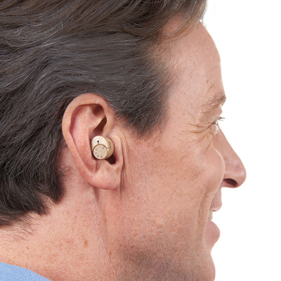 Mini-Hörverstärker, der im Innenohr platziert wird