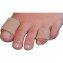 Gel-Schlauchbandage - 2