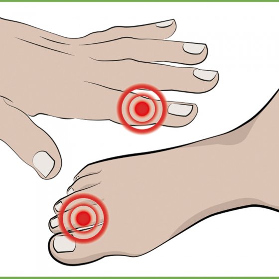 Finger- und Zehenschutz 