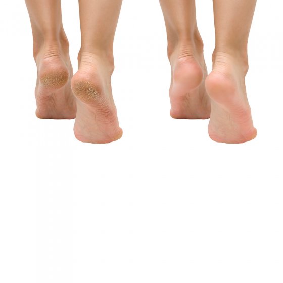 Fuß- und Nagelpilzspray 